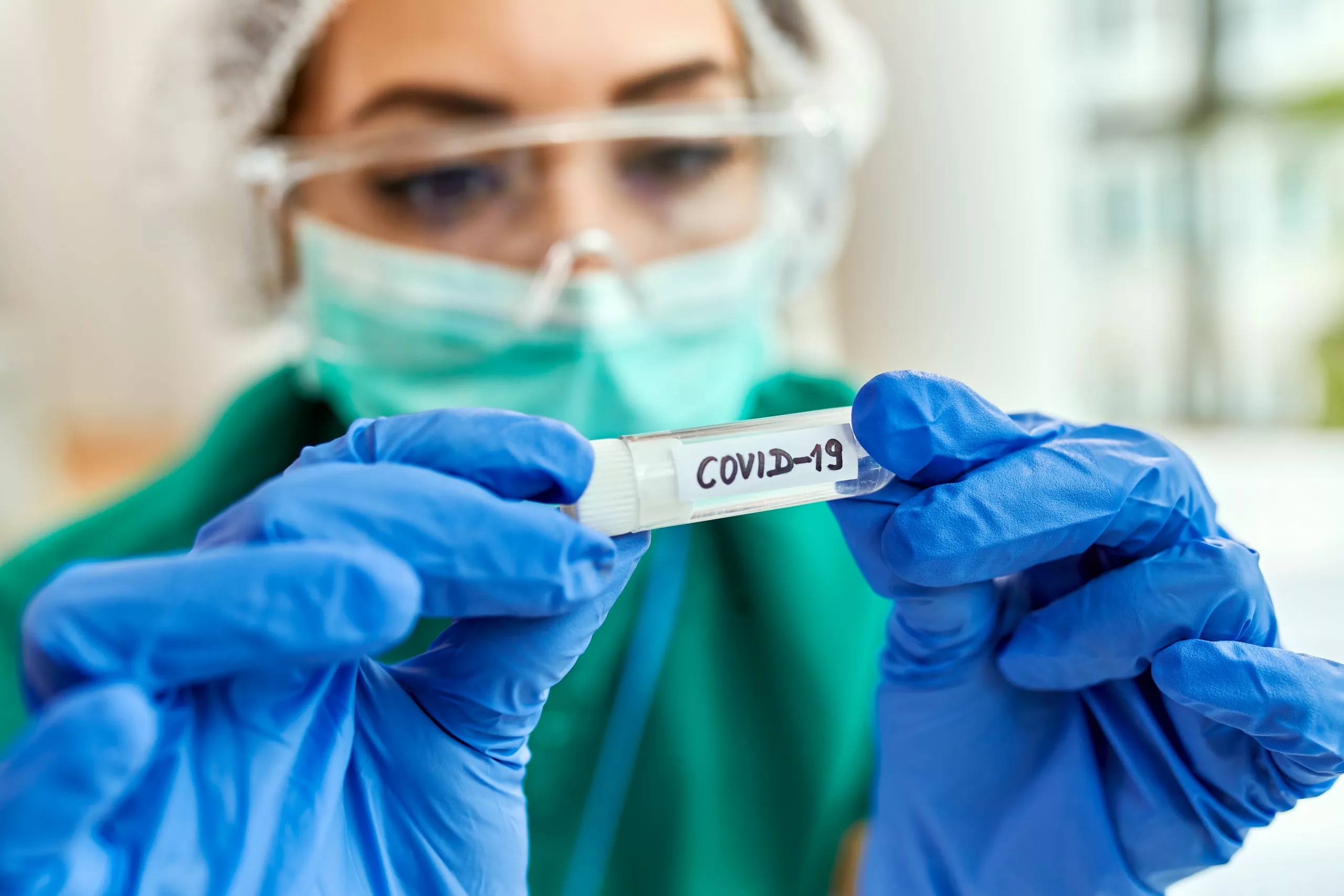 closeup-epidemiologist-with-covid19-sample-test-tube-min